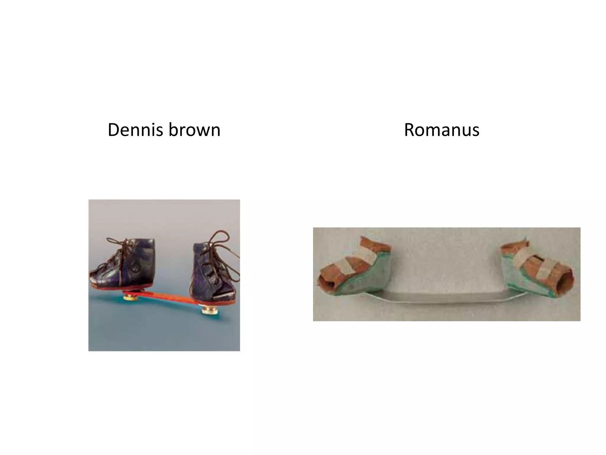 Dennis brown Romanus
 