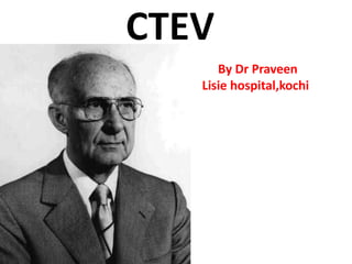CTEV
By Dr Praveen
Lisie hospital,kochi
 