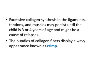 • Excessive collagen synthesis in the ligaments,
tendons, and muscles may persist until the
child is 3 or 4 years of age and might be a
cause of relapses.
• The bundles of collagen fibers display a wavy
appearance known as crimp.
 
