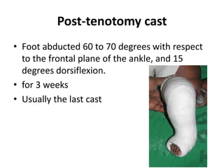 Post-tenotomy cast
• Foot abducted 60 to 70 degrees with respect
to the frontal plane of the ankle, and 15
degrees dorsiflexion.
• for 3 weeks
• Usually the last cast
 