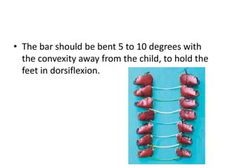 • The bar should be bent 5 to 10 degrees with
the convexity away from the child, to hold the
feet in dorsiflexion.
 