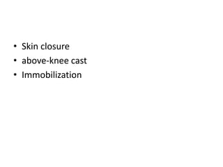 • Skin closure
• above-knee cast
• Immobilization
 