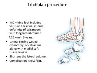 Litchblau procedure
• IND – hind foot includes
varus and residual internal
deformity of calcaneum
with long lateral column.
AGE – min 3 years.
• Lateral closing wedge
osteotomy of calcaneus
along with medial soft
tissue release .
• Shortens the lateral column.
• Complication- skew foot.
 