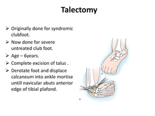 Talectomy
 Originally done for syndromic
clubfoot.
 Now done for severe
untreated club foot.
 Age – 6years.
 Complete excision of talus .
 Derotate foot and displace
calcaneum into ankle mortise
untill navicular abuts anterior
edge of tibial plafond.
 