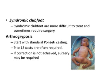• Syndromic clubfoot
– Syndromic clubfoot are more difficult to treat and
sometimes require surgery.
Arthrogryposis
– Start with standard Ponseti casting.
– 9 to 15 casts are often required.
– If correction is not achieved, surgery
may be required
 