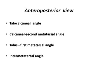 Anteroposterior view
• Talocalcaneal angle
• Calcaneal-second metatarsal angle
• Talus –first metatarsal angle
• Intermetatarsal angle
 