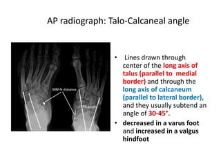 AP radiograph: Talo-Calcaneal angle
• Lines drawn through
center of the long axis of
talus (parallel to medial
border) and through the
long axis of calcaneum
(parallel to lateral border),
and they usually subtend an
angle of 30-45°.
• decreased in a varus foot
and increased in a valgus
hindfoot
 