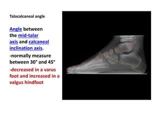 Talocalcaneal angle
Angle between
the mid-talar
axis and calcaneal
inclination axis.
-normally measure
between 30° and 45°
-decreased in a varus
foot and increased in a
valgus hindfoot
 