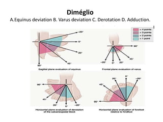 Diméglio
A.Equinus deviation B. Varus deviation C. Derotation D. Adduction.
 