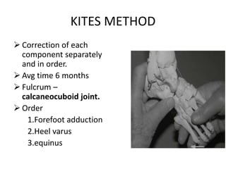 KITES METHOD
 Correction of each
component separately
and in order.
 Avg time 6 months
 Fulcrum –
calcaneocuboid joint.
 Order
1.Forefoot adduction
2.Heel varus
3.equinus
 