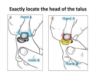 Exactly locate the head of the talus
 