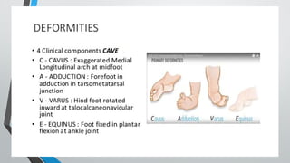 ctev ppt (congenitall talipes equino varus) | PPTX