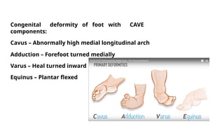 Comprehensive Overview and Management of Congenital Talipes Equino ...