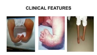 CLINICAL FEATURES
 