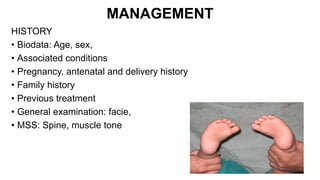 MANAGEMENT
HISTORY
• Biodata: Age, sex,
• Associated conditions
• Pregnancy, antenatal and delivery history
• Family history
• Previous treatment
• General examination: facie,
• MSS: Spine, muscle tone
 