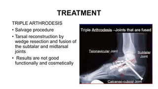 TREATMENT
TRIPLE ARTHRODESIS
• Salvage procedure
• Tarsal reconstruction by
wedge resection and fusion of
the subtalar and midtarsal
joints
• Results are not good
functionally and cosmetically
 