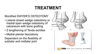 TREATMENT
Mordified DWYER’S OSTEOTOMY
• Lateral closed wedge osteotomy or
medial open wedge osteotomy of
calcaneum with bone grafting
• Z lengthening of Tendo-achilles
• Medial plantar fasciotomy
Dependent on the flexibility of
subtalar and midtalar joint
 