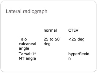 CONGENITAL TALIPES EQUINOVARUS | PPT