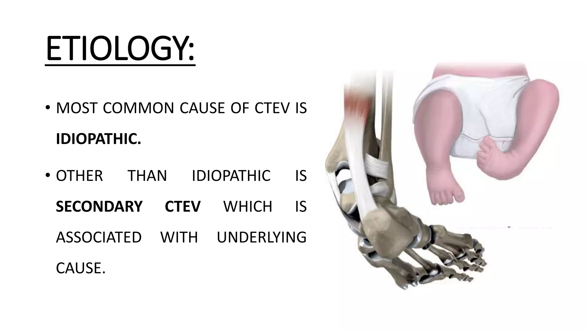 Congenital talipes equinovarus foot/ctev) ppt by Dr Pratik PPT