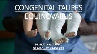 CONGENITAL TALIPES
EQUINOVARUS
DR PRATIK AGARWAL
DR MADHAV KHADILKAR
 