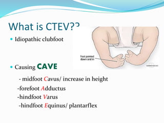 Ctev Types Ctev prof g s patnaik | PPTX