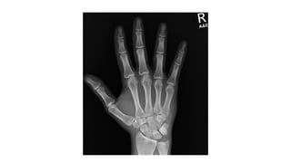 CT Examination Techniques for Extremities_7f6430ec-2fa0-4c32-b995 ...