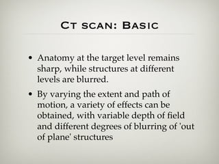 Ct final pp presentation | KEY