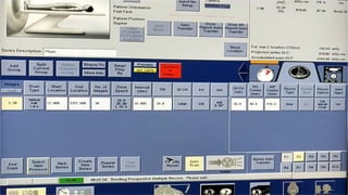 CT SCAN DATA ACQUISITION PROCESS & SCANNING PROGRAM | PPTX