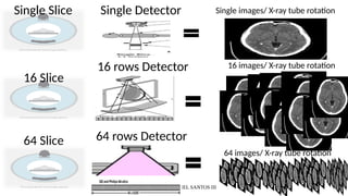 CT SCAN DATA ACQUISITION PROCESS & SCANNING PROGRAM | PPTX