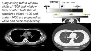 CT SCAN DATA ACQUISITION PROCESS & SCANNING PROGRAM | PPTX