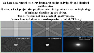 CT SCAN DATA ACQUISITION PROCESS & SCANNING PROGRAM | PPTX