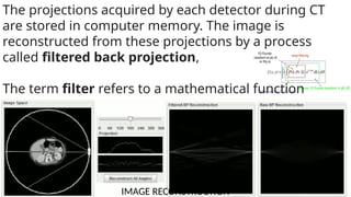 CT SCAN DATA ACQUISITION PROCESS & SCANNING PROGRAM | PPTX