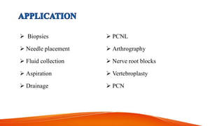 Biopsies
 Needle placement
 Fluid collection
 Aspiration
 Drainage
 PCNL
 Arthrography
 Nerve root blocks
 Vertebroplasty
 PCN
 