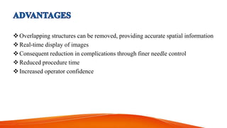 Overlapping structures can be removed, providing accurate spatial information
Real-time display of images
Consequent reduction in complications through finer needle control
Reduced procedure time
Increased operator confidence
 