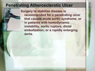 Aortic Intramural HematomaAcute intramural hematoma is easily recognized in CT without contrast enhancement  by the higher Hounsfield-unit value of the blood products in the wall in comparison with the flowing blood in the lumen, eccentric aortic wall-thickening and displacement of intimal calcifications.