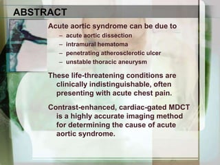ABSTRACTAcute aortic syndrome can be due to acute aortic dissectionintramural hematomapenetrating atherosclerotic ulcerunstable thoracic aneurysmThese life-threatening conditions are clinically indistinguishable, often presenting with acute chest pain.Contrast-enhanced, cardiac-gated MDCT is a highly accurate imaging method for determining the cause of acute aortic syndrome.