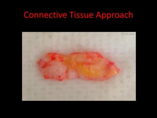 Connective Tissue Approach
                       Dr. Yair Lenga
 