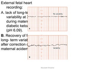External fetal heart
recording:
A. lack of long-term
variability at 31 w
during maternal
diabetic ketoacidosis
(pH 6.09).
B. Recovery of fetal
long- term variability
after correction of
maternal acidemia.
Aboubakr Elnashar
 