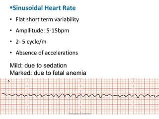 Sinusoidal Heart Rate
• Flat short term variability
• Ampllitude: 5-15bpm
• 2- 5 cycle/m
• Absence of accelerations
Mild: due to sedation
Marked: due to fetal anemia
Aboubakr Elnashar
 