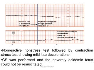 •Nonreactive nonstress test followed by contraction
stress test showing mild late decelerations.
•CS was performed and the severely acidemic fetus
could not be resuscitated.
Aboubakr Elnashar
 