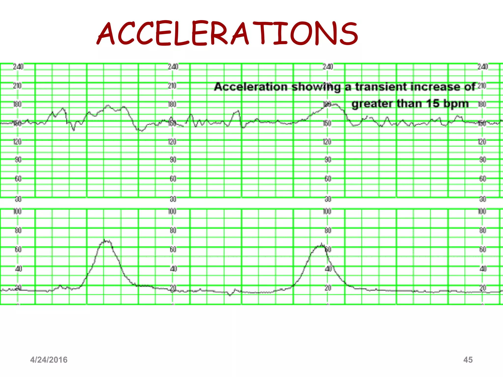 Cardiotocography | PPTX