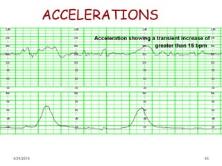 Cardiotocography | PPTX