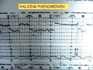Cardiotocography | PPTX