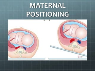 MATERNAL
POSITIONING
 