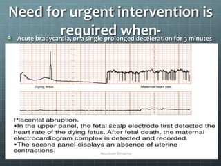 Need for urgent intervention is
required when-Acute bradycardia, or a single prolonged deceleration for 3 minutes
or more
Management –
Urgently seek obstetric help
If there has been an acute event (for example, cord prolapse,
suspected placental abruption or suspected uterine rupture), expedite
the birth
Correct any underlying causes, such as hypotension or uterine
hyperstimulation
Start 1 or more conservative measures*
Make preparations for an urgent birth
Talk to the woman and her birth companion(s) about what is
happening and take her preferences into account
Expedite the birth if the acute bradycardia persists for 9 minutes
If the fetal heart rate recovers at any time up to 9 minutes, reassess
any decision to expedite the birth, in discussion with the woman
 