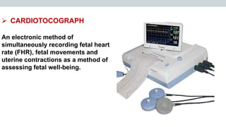 CTG.pdf continous tomography electronic fetal | PDF