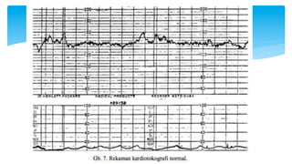 CTG-Dokterpost kardiotokografi obgyn.pdf