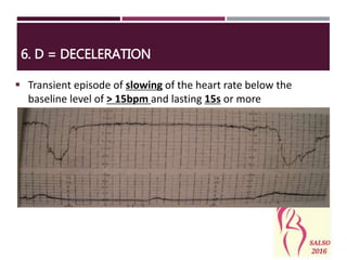  Transient episode of slowing of the heart rate below the
baseline level of > 15bpm and lasting 15s or more
6. D = DECELERATION
 