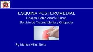 ESQUINA POSTEROMEDIAL
Hospital Pablo Arturo Suarez
Servicio de Traumatología y Ortopedia
Pg Marlon Miller Neira
 