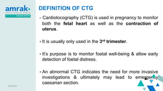 CTG presentation.pptx